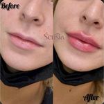 کلینیک زیبایی و مرکز لیزر سنسیا