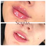 کلینیک زیبایی و مرکز لیزر سنسیا