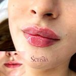 کلینیک زیبایی و مرکز لیزر سنسیا