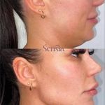 کلینیک زیبایی و مرکز لیزر سنسیا