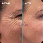 کلینیک زیبایی و مرکز لیزر سنسیا