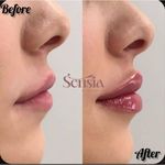 کلینیک زیبایی و مرکز لیزر سنسیا