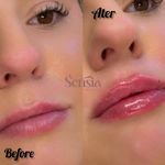 کلینیک زیبایی و مرکز لیزر سنسیا