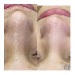 کلینیک زیبایی و مرکز لیزر سنسیا