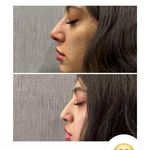 کلینیک زیبایی و مرکز لیزر سنسیا