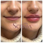 کلینیک زیبایی و مرکز لیزر سنسیا