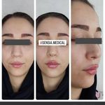 کلینیک زیبایی و مرکز لیزر سنسیا