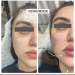 کلینیک زیبایی و مرکز لیزر سنسیا