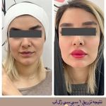 کلینیک زیبایی و مرکز لیزر سنسیا