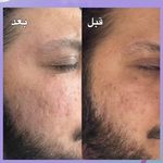 کلینیک زیبایی و مرکز لیزر سنسیا