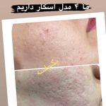 کلینیک زیبایی و مرکز لیزر سنسیا