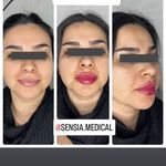 کلینیک زیبایی و مرکز لیزر سنسیا