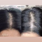 کلینیک زیبایی و مرکز لیزر سنسیا