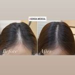 کلینیک زیبایی و مرکز لیزر سنسیا