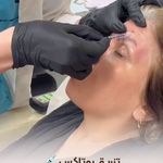 کلینیک زیبایی بهسا