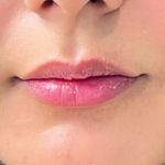 کلینیک زیبایی رز سفید