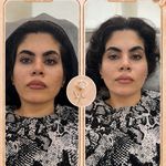 کلینیک زیبایی رز سفید (دکتر کاشانی)