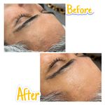 خدمات تخصصی فیشال سارا اسکین بار