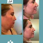 تغذیه و لاغری راز