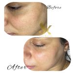 خدمات تخصصی فیشال سارا اسکین بار