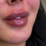 کلینیک زیبایی نورارُز پردیس