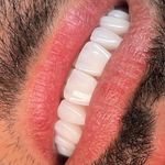 دندان پزشکی آمیس