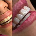 دندان پزشکی آمیس