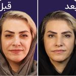 کلینیک زیبایی الماس کاملا اقساطی