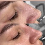 مژگان اسکین کرMojgan skincare