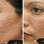 دکتر نیلوفر سلیمانی پوست و مو و زیبایی