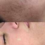 فیشال و خدمات پاکسازی پوست  فاطمه انامی