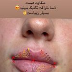 کلینیک زیبایی خانم محمدرضایی پوست ومو