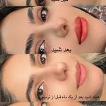 سالن زیبایی و مرکز تخصصی میکرو سما ستوده