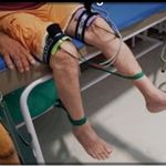 خدمات فیزیوتراپی و توانبخشی در منزل بهفر