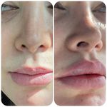 کلینیک لیزر  کندلاوزیبایی پوست ومو آیشیل