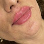 کلینیک پوست،زیبایی ولیزر اِلی(کندلا2025)