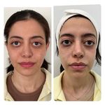 کلینیک زیبایی هانا