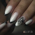 کاشت و ترمیم ناخن شهریار ملینا