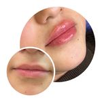 کلینیک زیبایی مهر دخت آتوسا