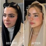 کلینیک زیبایی راشا