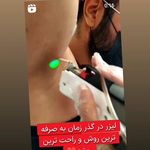 کلینیک لیزر شیلا