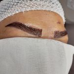 کاشت ابرو و موی باران