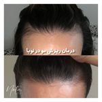 کلینیک زیبایی و لیزر مو زائد نوبا