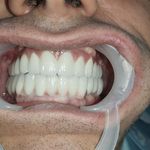 مطب ایمپلنت دکتر نیما شفیعی