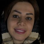 دندانپزشکی دکتر پریا آقاخانی(اقساط)