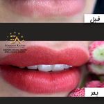 مرکز تخصصی آرایش دائم سمیه کاظمی