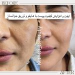 مرکز لیزر ،پوست و زیبایی کندی بیوتی