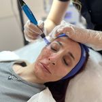 فیشیال و پاکسازی پوست نگارتیپس