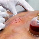 کلینیک طب سوزنی سنتی سینا