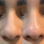 خدمات فیشال ،پاکسازی ندادمیرچی کلینیکBKD